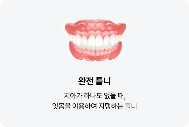 mo-틀니종류01