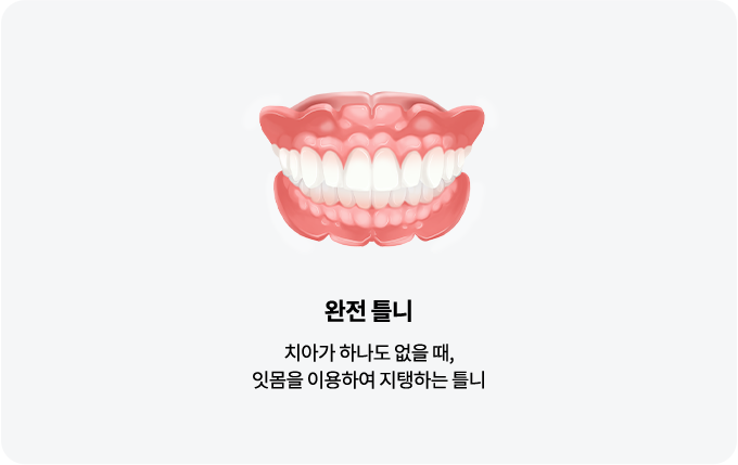 틀니종류-완전틀니